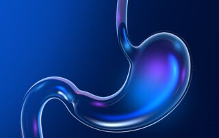 3D απεικόνιση στομάχου που χρησιμοποιείται για ενημέρωση σχετικά με πολύποδες στομάχου και ενδοσκοπική αφαίρεση.